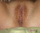Fotze