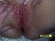 Fotze