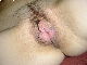 Fotze