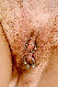 Fotze