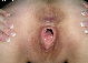 feuchtes Fickloch