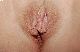 Fotze
