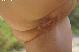 Fotze